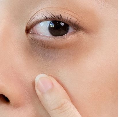 10 Causes of Dark Circles and How To Tackle Them
